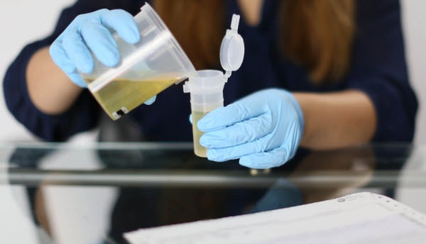 drug test